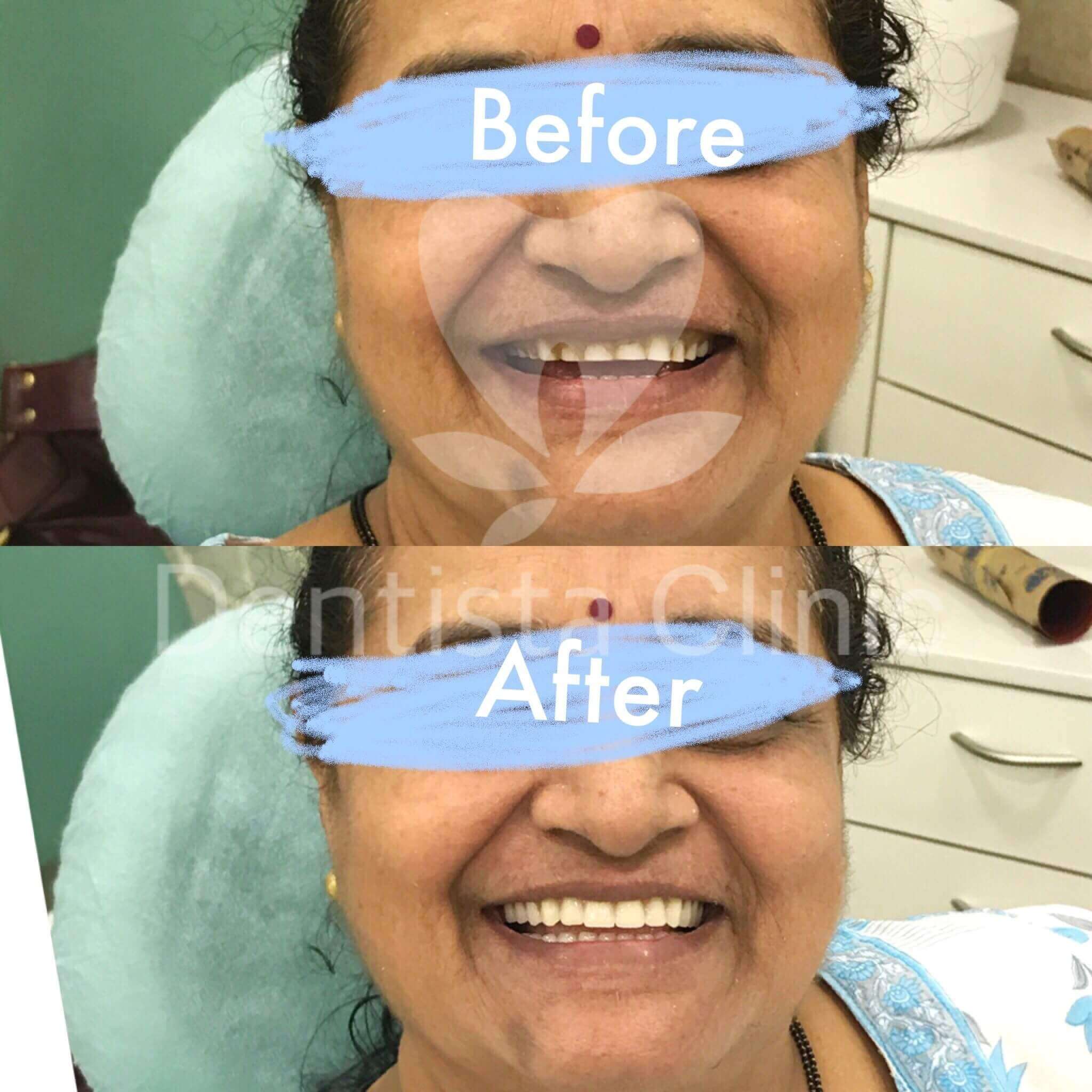 before after treatments