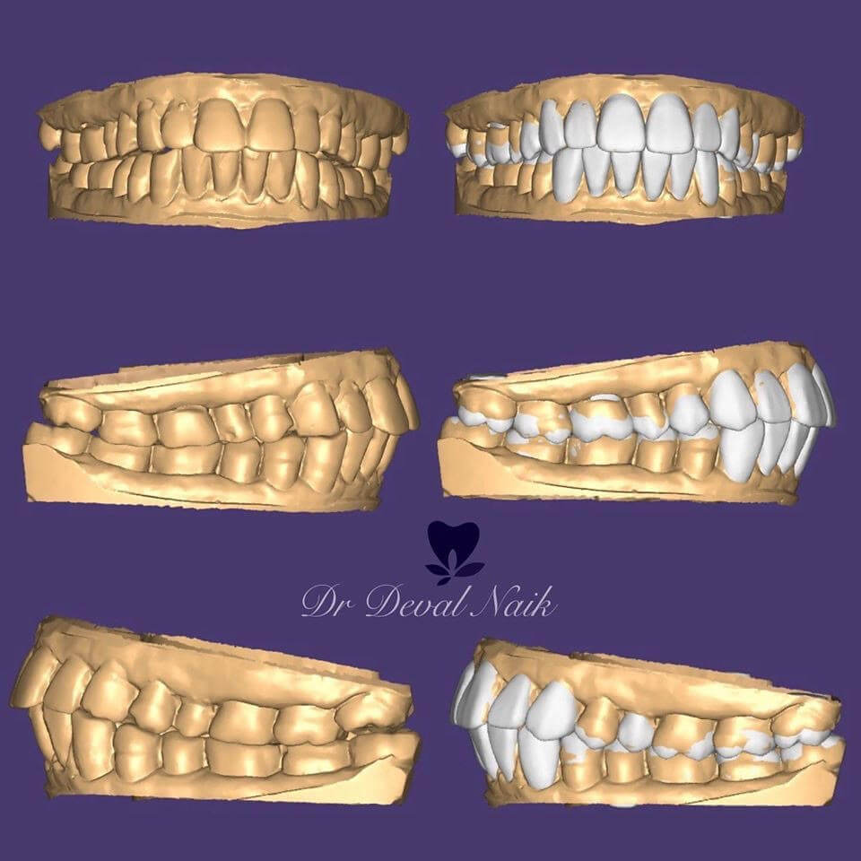 dental treatments and cleaness